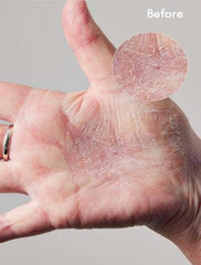 Lano 101 Dry Skin Super Cream 60ml