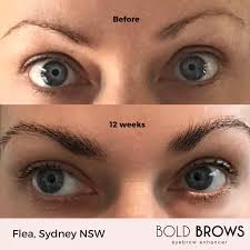 Can Gro Bold Brows Eyebrow Enhancer 3.5ml