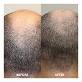 Evolis Hair Growth Tonic for Men 50ml