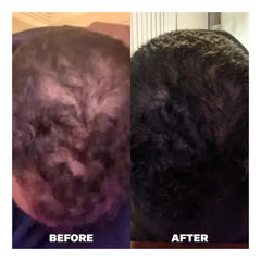 Evolis Let There Be Hair 60 capsules