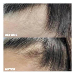 Evolis Let There Be Hair 60 capsules