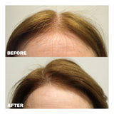Evolis Hair Growth Tonic for Women