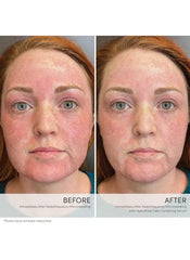 Jane Iredale HydroPure Color Correcting Serum