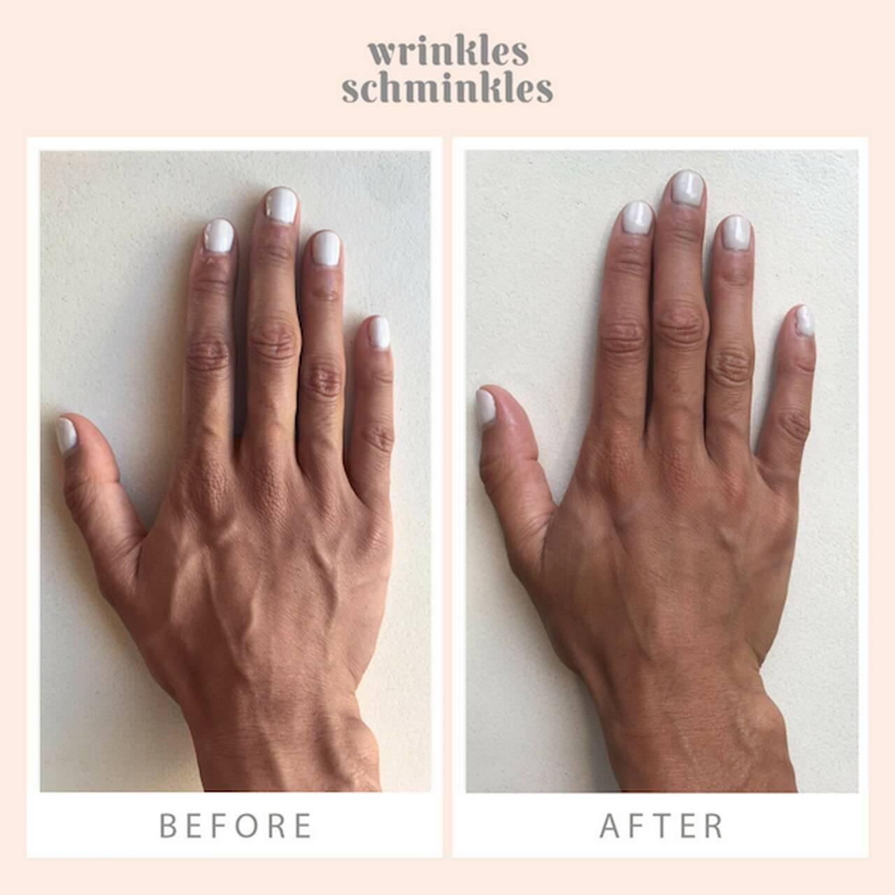 Wrinkles Schminkles Hand Smoothing Kit