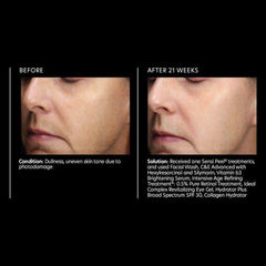 PCA Skin Vitamin B3 Brightening Serum 30ml.