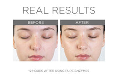 Cosmedix Pure Enzymes 60g