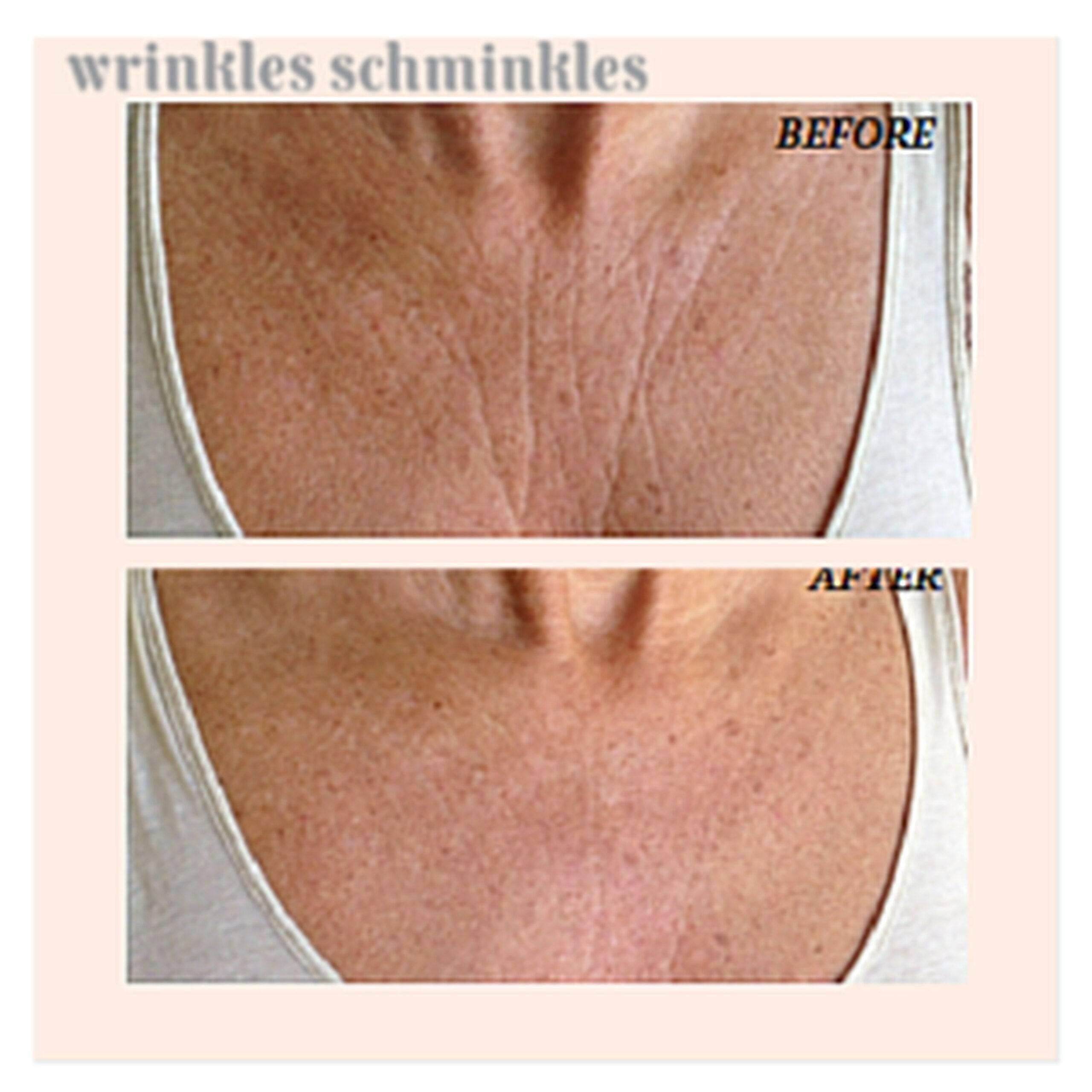 Wrinkles Schminkles Chest & Decolletage Smoothing Kit