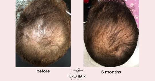 Can Gro Hair Growth Serum 30ml