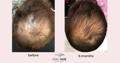 Can Gro Hair Growth Serum 30ml