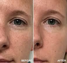 HydroPeptide Anti Wrinkle Polish and Plump Peel Set