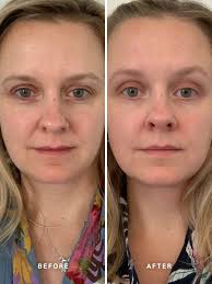 Can Gro Vitamin A Retinol 0.50% 30ml