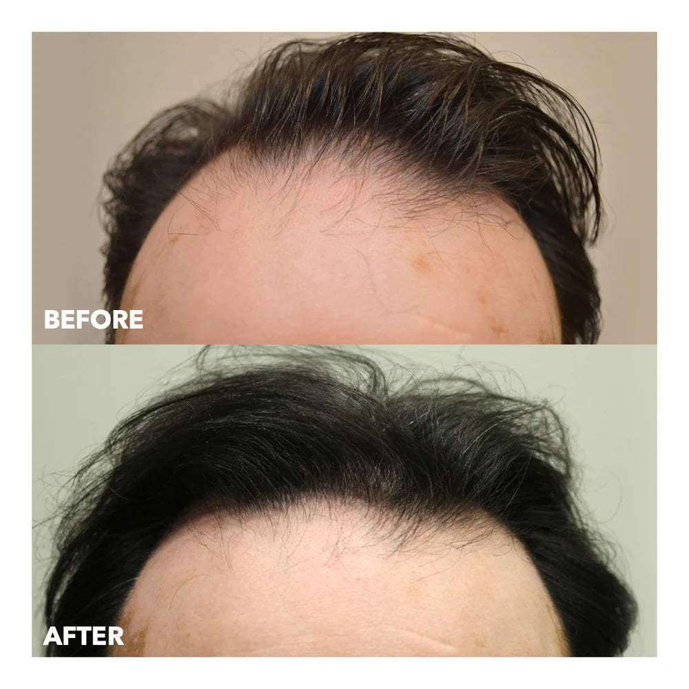 Evolis Hair Growth Tonic for Men 50ml