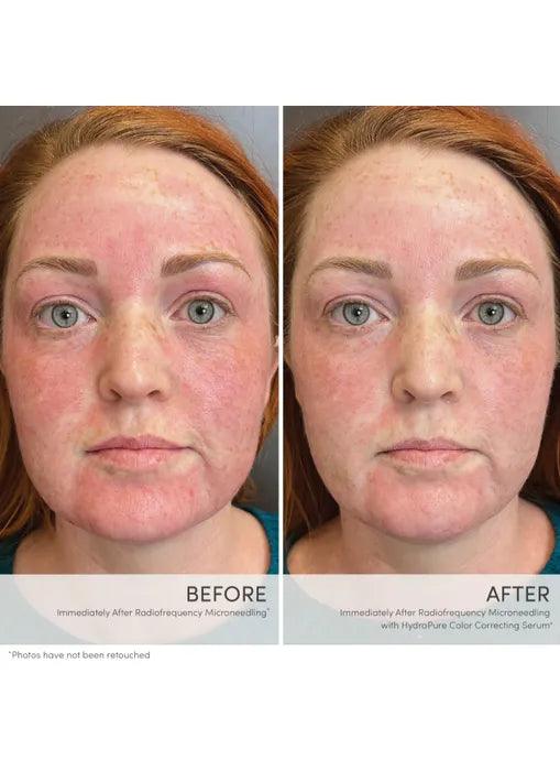 Jane Iredale HydroPure Color Correcting Serum