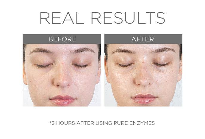 Cosmedix Pure Enzymes 60g