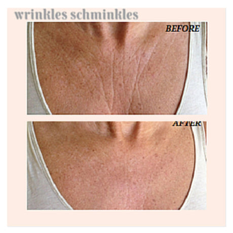 Wrinkles Schminkles Chest & Decolletage Smoothing Kit