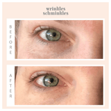 Wrinkles Schminkles Eye Wrinkles Patch