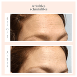 Wrinkles Schminkles Forehead Wrinkle Patch Kit